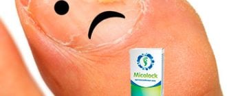 Противогрибковая мазь Micolock