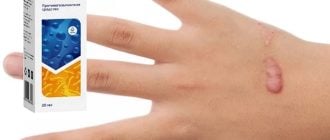 WORTEX от папиллом и бородавок: эффективное лечение и профилактика папилломавируса и глистной инвазии!